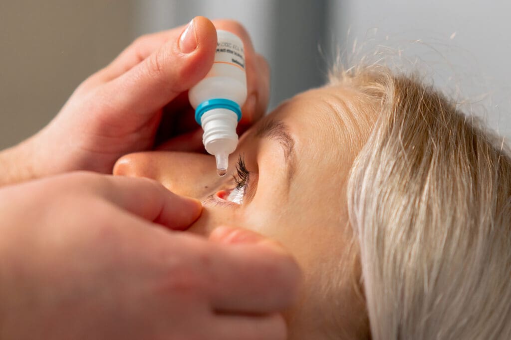 close up of ophthalmologist giving a girl antibiotic eye drops to treat her blepharitis