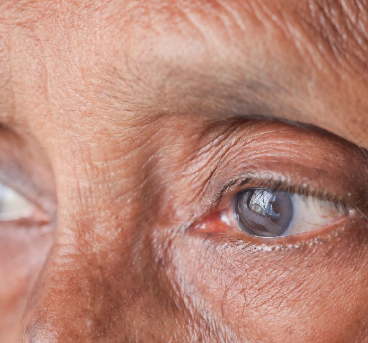 detail shot of asian senior women eye ,