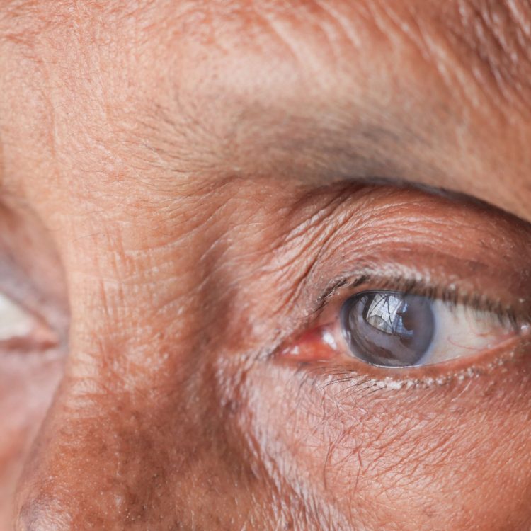 detail shot of asian senior women eye ,